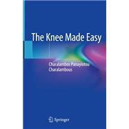 The Knee Made Easy