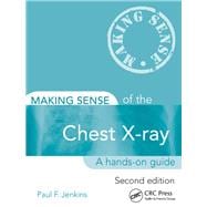 Making Sense of the Chest X-ray, Second Edition: A hands-on guide