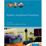 Pediatric Anesthesia Procedures