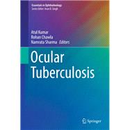 Ocular Tuberculosis