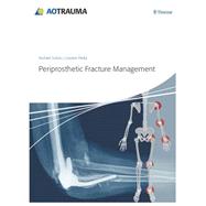 Periprosthetic Fracture Management