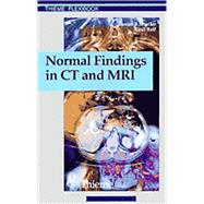 Normal Findings in Ct and MRI