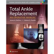 Total Ankle Replacement:  An Operative Manual