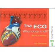 The ECG: What Does It Tell?