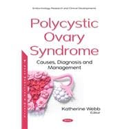 Polycystic Ovary Syndrome: Causes, Diagnosis and Management