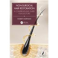 Non-Surgical Hair Restoration