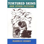 Tortured Skins and Other Fictions