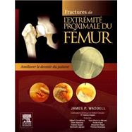 Fractures de l'extrémité proximale du fémur