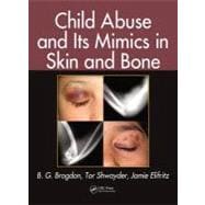 Child Abuse and Its Mimics in Skin and Bone