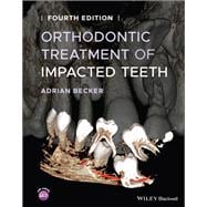 Orthodontic Treatment of Impacted Teeth