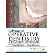 Advanced Operative Dentistry: A Practical Approach