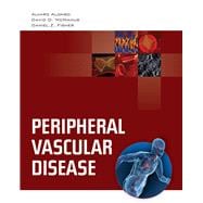 Peripheral Vascular Disease