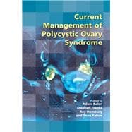 Current Management of Polycystic Ovary Syndrome