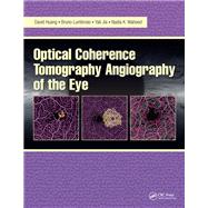 Optical Coherence Tomography Angiography of the Eye