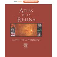 Atlas de la retina