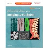 Imaging of the Spine