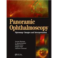 Panoramic Ophthalmoscopy