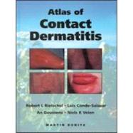 An Atlas of Contact Dermatitis