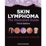 Skin Lymphoma : The Illustrated Guide