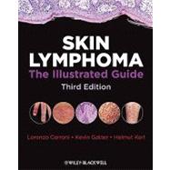 Skin Lymphoma : The Illustrated Guide