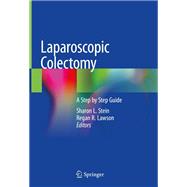 Laparoscopic Colectomy