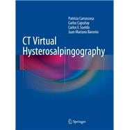 Ct Virtual Hysterosalpingography