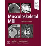 Musculoskeletal MRI