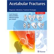 Acetabular Fractures