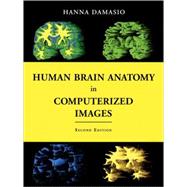 Human Brain Anatomy in Computerized Images