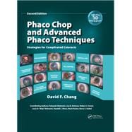 Phaco Chop and Advanced Phaco Techniques