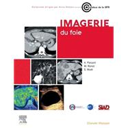 Imagerie du foie