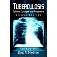 Tuberculosis: Current Concepts and Treatment, Second Edition
