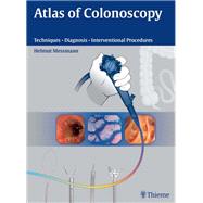 Atlas of Colonoscopy: Examination Techniques and Diagnosis