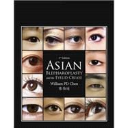 Asian Blepharoplasty and the Eyelid Crease