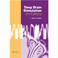 Deep Brain Stimulation and Epilepsy