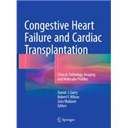 Congestive Heart Failure and Cardiac Transplantation