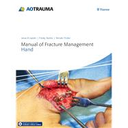 Manual of Fracture Management - Hand