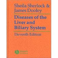 Diseases of the Liver and Biliary System, 11th Edition,9780632055821