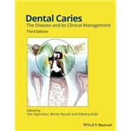 Dental Caries The Disease and its Clinical Management