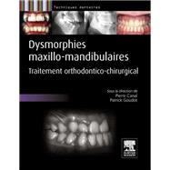 Dysmorphies maxillo-mandibulaires