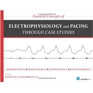 Essential Concepts of Electrophysiology and Pacing Through Case Studies