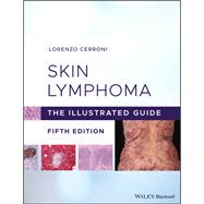 Skin Lymphoma The Illustrated Guide