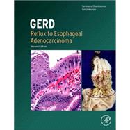 Gerd: Reflux to Esophageal Adenocarcinoma