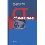 CT of Metastases