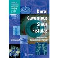 Dural Cavernous Sinus Fistulas