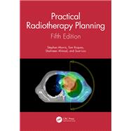 Practical Radiotherapy Planning