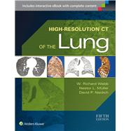 High-resolution Ct of the Lung