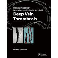 Practical Phlebology Deep Vein Thrombosis