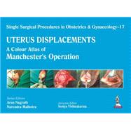 Uterus Displacements