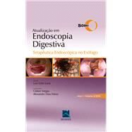 SOBED Atualização em Endoscopia Digestiva - Volume 2  : Terapêutica Endoscópica no Esôfago - Ano 1